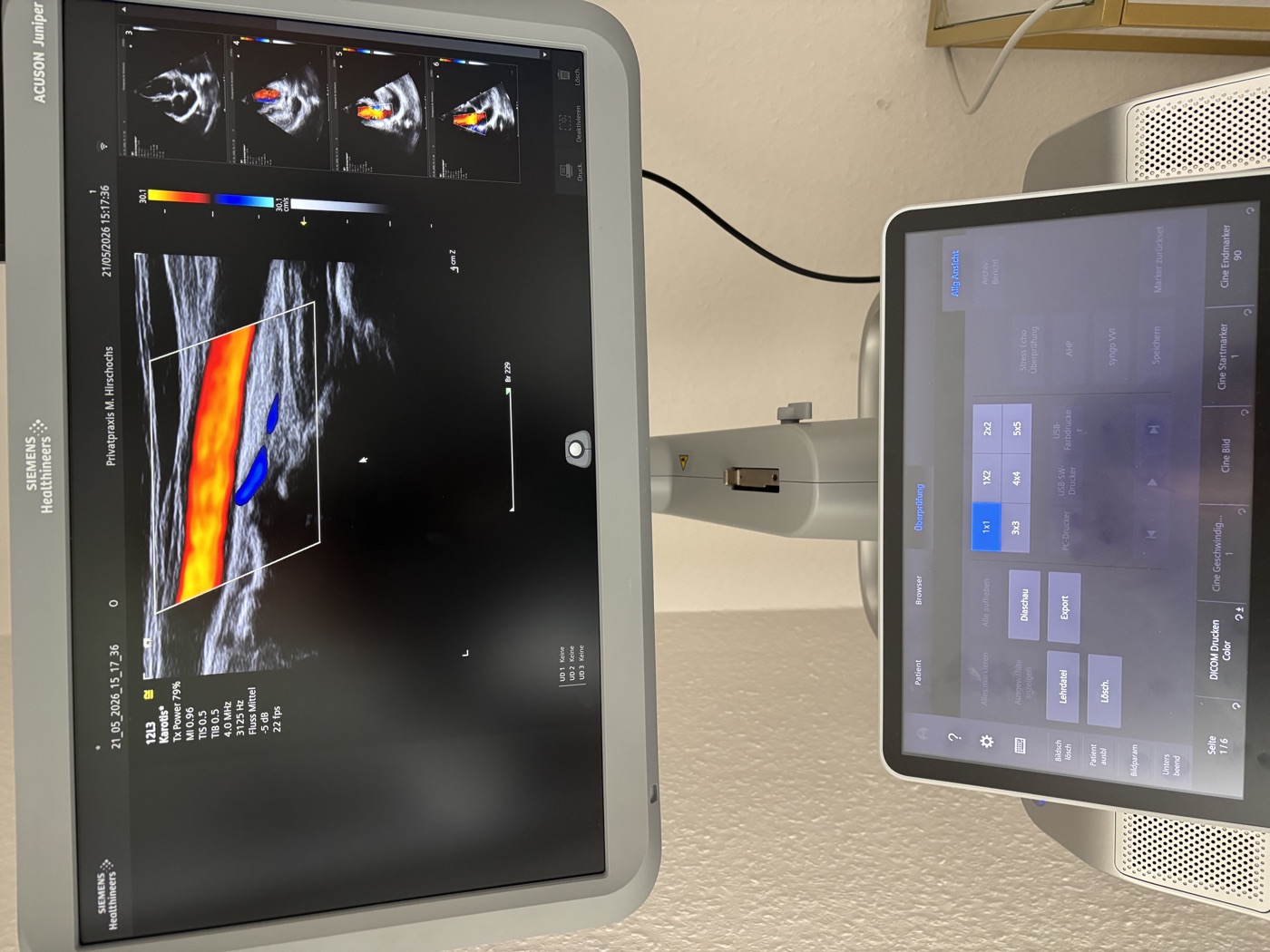 Ultraschallgerät mit Aufnahme der Halsschlagader im Farbdoppler