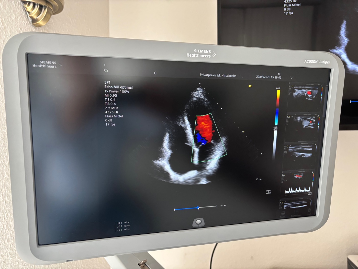Monitor des Ultraschallgeräts mit einem Herzultraschall im Farbdoppler