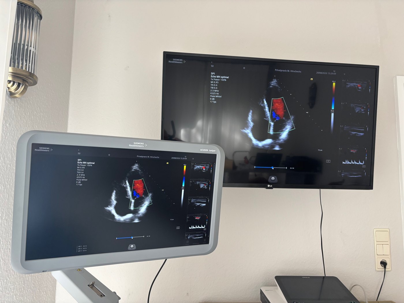 Zwei Monitore der Praxis mit einer Herzultraschall-Aufnahme im Farbdoppler