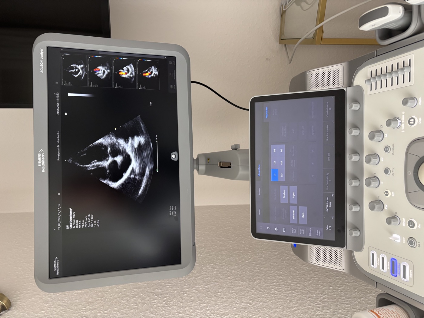 Ultraschallgerät der Praxis mit Monitor und Bedienfeld